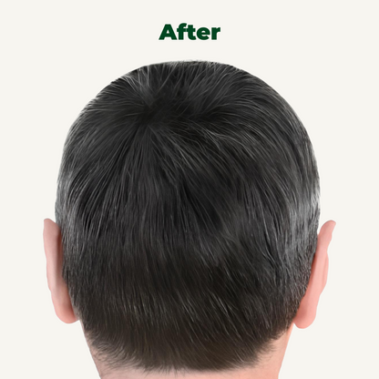 LED Сap for Нair growth restoration