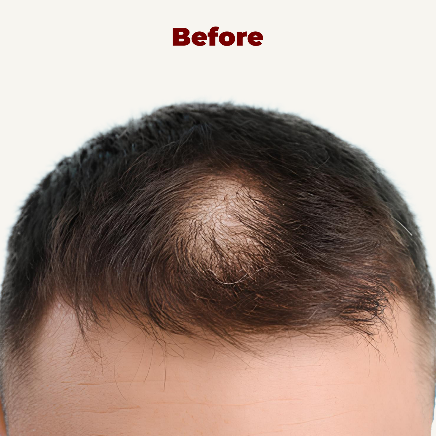 LED Сap for Нair growth restoration