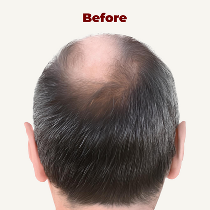 LED Сap for Нair growth restoration