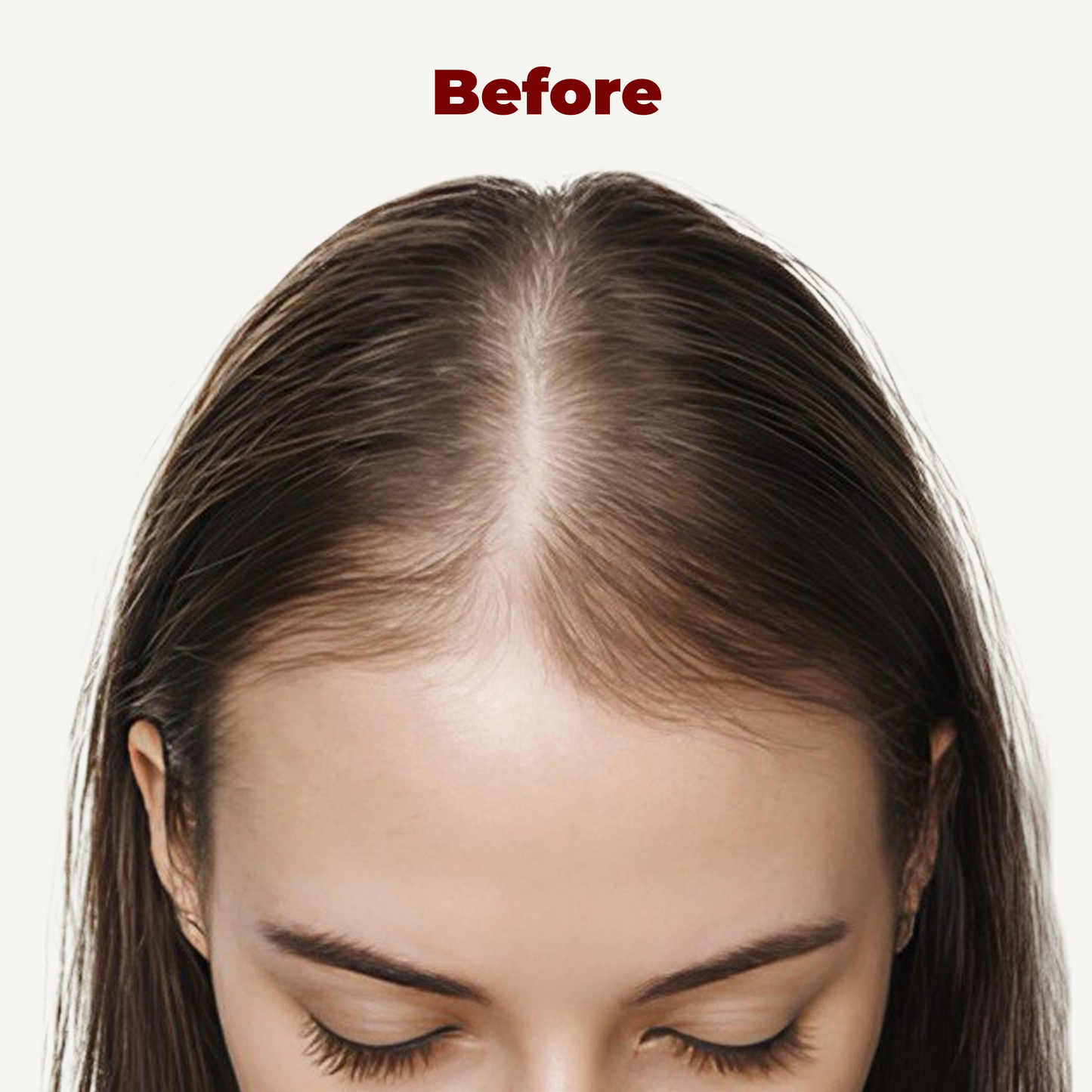 LED Сap for Нair growth restoration